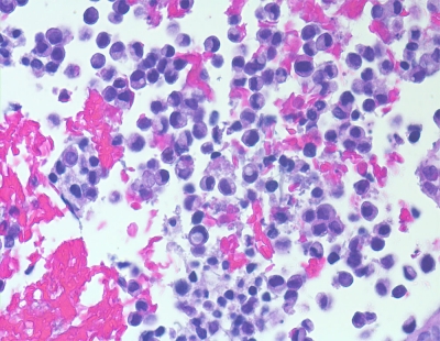 CITOPATOLOGIA
