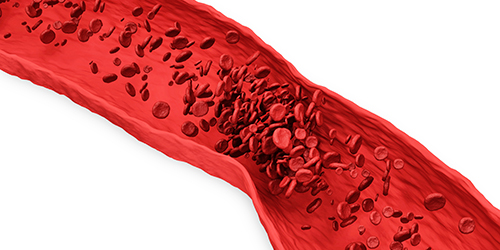 HEMOSTASIA