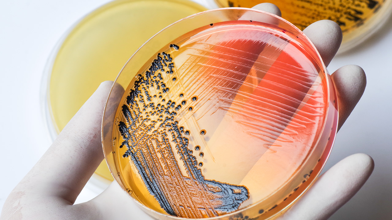 MICROBIOLOGIA