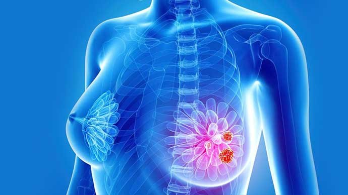 ONCOGENÉTICA